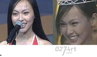 龅牙娱乐吃瓜,揭秘娱乐圈吃瓜背后的真相与笑料